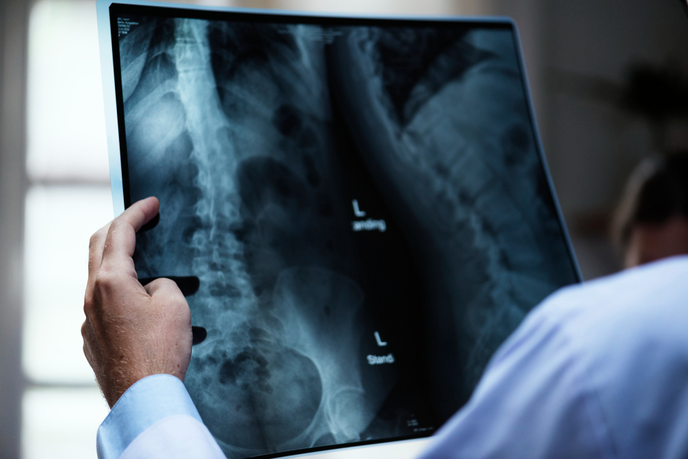 Importance of Taking X-rays in Chiropractor care